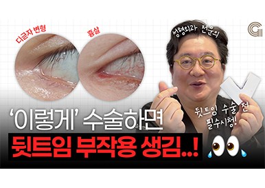 '이렇게' 수술하면 뒷트임 부작용 생김..!