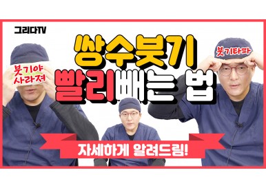 쌍꺼풀수술 후 붓기 빨리 빼는법! 자세하게 알려드릴께요! /그리다성형외과