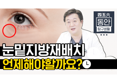 눈밑지방재배치 언제 해야 할까요? 3편