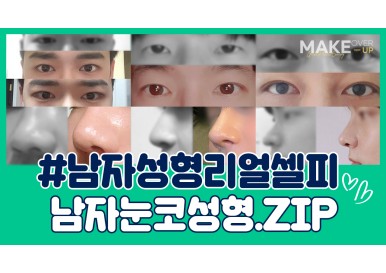 [남자성형] 눈성형, 코성형 리얼셀피.zip