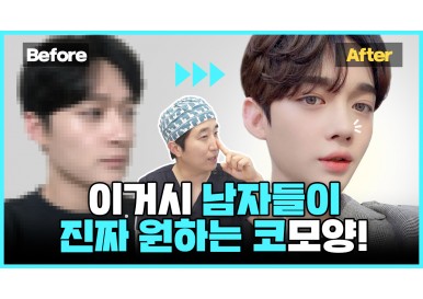 [남자코성형] 이것이 남자들이 진짜 원하는 코모양! (남자코Q&A/ 남자연예인코 / 코수술후 주의사항!)