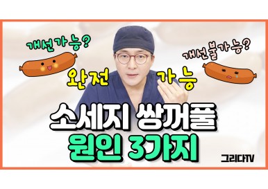 소세지쌍꺼풀 원인 3가지 (개선가능? 불가능?)