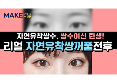 자연유착쌍꺼풀 수술로 자연스럽게~ 