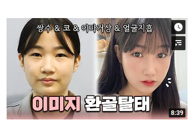 [성형 브이로그] 원선의님 1편