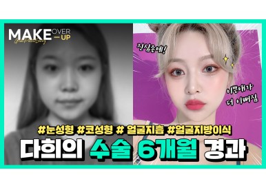 [메이크오버업] 눈.코.지 셀카경과