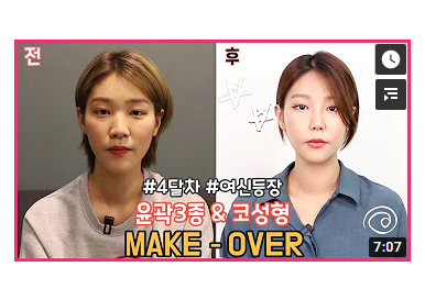 [성형 브이로그] 최한나님 2편