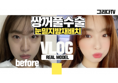 [성형 브이로그] 황지수님 1편