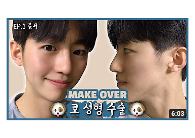 [성형 브이로그] 설준서님 1편