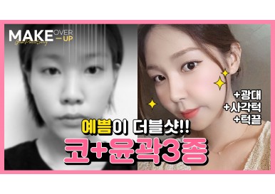 [메이크오버업] 안면윤곽,코성형 셀카경과