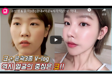 [성형 브이로그] 최한나님 2편