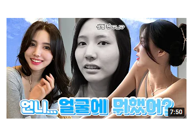[성형 브이로그] 임지연님 1편